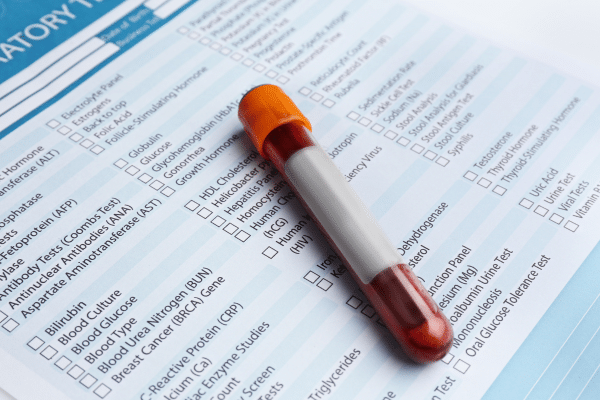 vial of blood taken for heart health workup